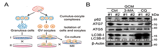 图1：颗粒细胞-卵母细胞共培养模型及自噬抑制效率的验证